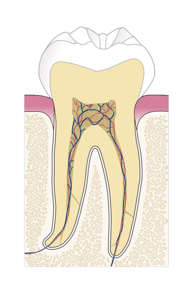 Wird grau zahn wurzelbehandelter Wie lange